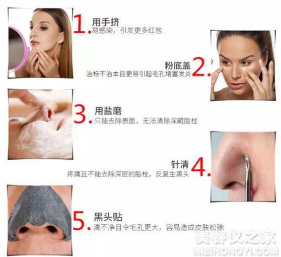 去黑頭的簡單小妙招，去黑頭小妙招分享，輕松告別黑頭困擾