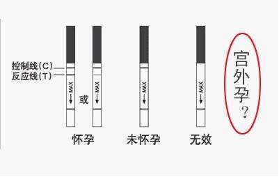一深一淺說(shuō)明有排卵嗎？深度解析女性排卵現(xiàn)象及相關(guān)因素，深度解析，女性排卵現(xiàn)象及其與深淺關(guān)系探討