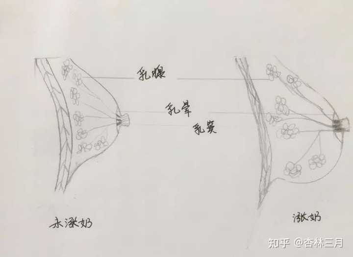 乳房硬塊消除，了解成因與應(yīng)對方法，乳房硬塊消除，成因解析與應(yīng)對方法指南