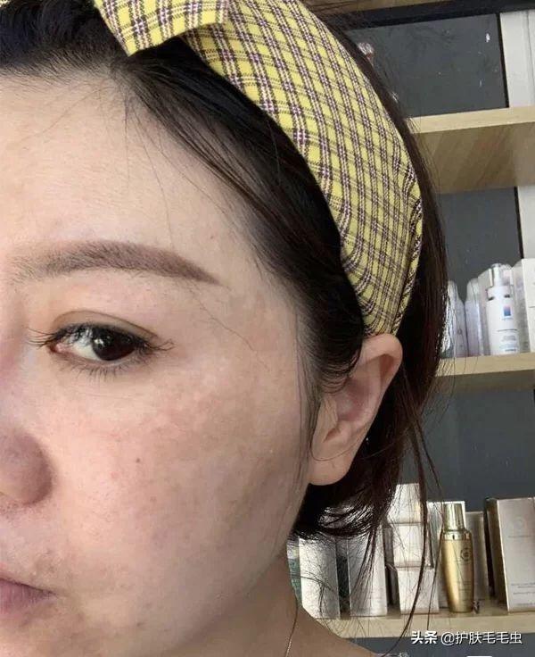 怎樣有效的淡化黃褐斑——全方位美白祛斑攻略，全方位美白祛斑攻略，如何有效淡化黃褐斑