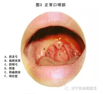 慢性咽炎三天斷根，真相還是幻想？，慢性咽炎三天斷根，真相還是幻想？揭秘治療真相。