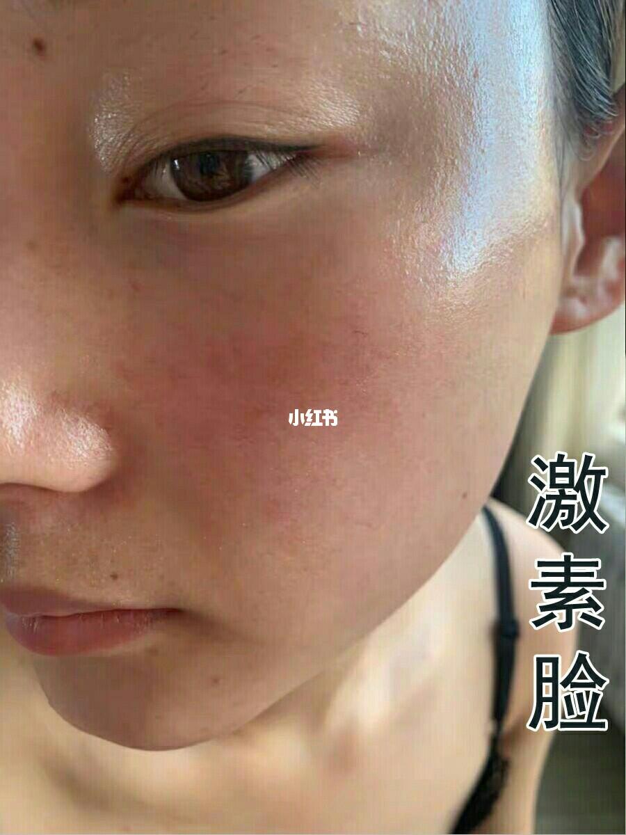 面部激素臉圖片及其相關(guān)問題解析，面部激素臉圖片解析及相關(guān)問題探討