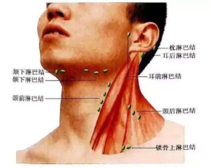 頸部淋巴結(jié)自檢手法，了解、預(yù)防與早期發(fā)現(xiàn)，頸部淋巴結(jié)自檢手法詳解，了解、預(yù)防與早期發(fā)現(xiàn)的重要性