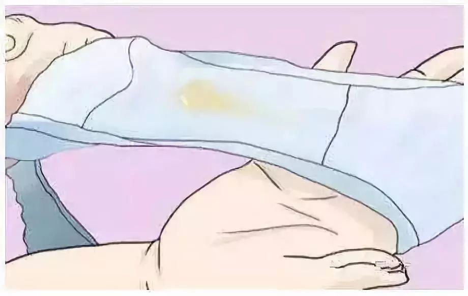 了解女性健康，白帶是什么樣子的圖片詳解，女性健康知識普及，白帶形態(tài)詳解及圖片介紹