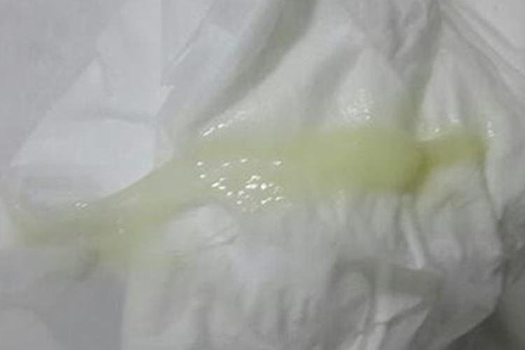 白帶黃綠色的原因及應(yīng)對(duì)方法，了解你的身體狀況，白帶黃綠色原因解析與應(yīng)對(duì)方法，關(guān)注你的身體健康