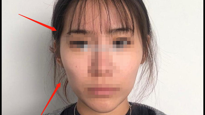 顴骨突出臉型圖，解析臉型特點(diǎn)與修飾技巧，顴骨突出臉型解析及修飾技巧圖解