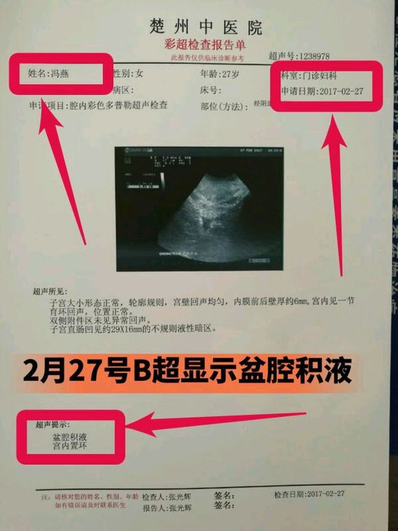 盆腔積液怎么治療，全面解析最佳治療方案，全面解析，盆腔積液的最佳治療方案