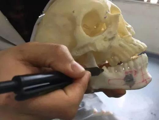 智齒的形態(tài)與圖片解析，了解牙齒生長的最后階段，智齒形態(tài)與圖片解析，探究牙齒生長最后階段的全貌