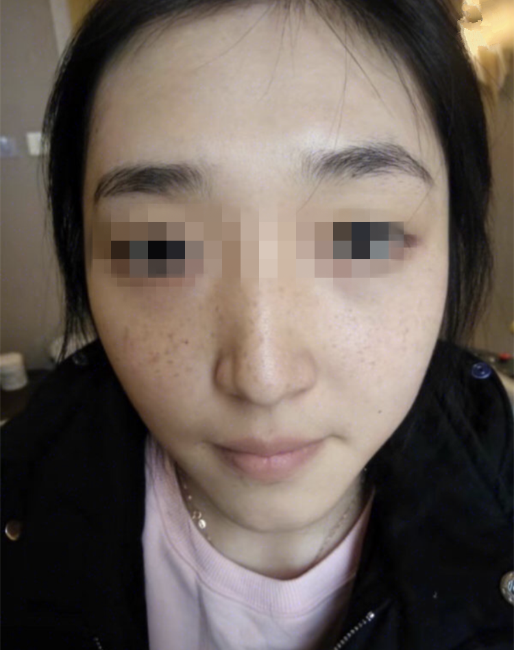 正規(guī)醫(yī)院祛斑效果深度解析，安全與效果的雙重保障，正規(guī)醫(yī)院祛斑效果深度解析，雙重保障下的安全與效果體驗(yàn)