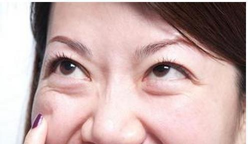 如何消除眼袋，方法與技巧詳解，消除眼袋的有效方法與技巧全解析