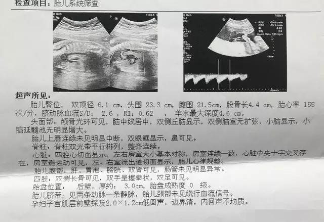 殲-11B重型戰(zhàn)斗機(jī)，卓越性能與先進(jìn)技術(shù)的完美結(jié)合，殲-11B重型戰(zhàn)斗機(jī)，卓越性能與技術(shù)的巔峰融合