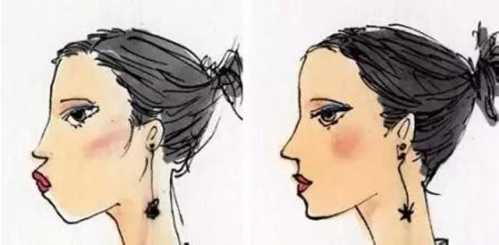 鼻子整形后能否永久保持？全面解析鼻子整形手術(shù)的持久性，鼻子整形手術(shù)的持久性與永久保持的可能性解析