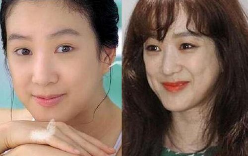 揭秘，韓國整容失敗的十大明星，揭秘，韓國整容失敗的明星TOP 10名單曝光