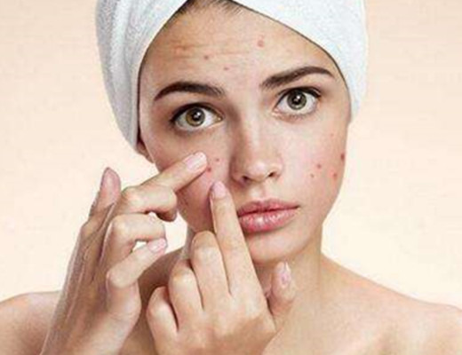 如何去掉青春痘小妙招，實用指南助你擺脫肌膚困擾，青春痘消除小妙招，實用指南助你擺脫肌膚問題