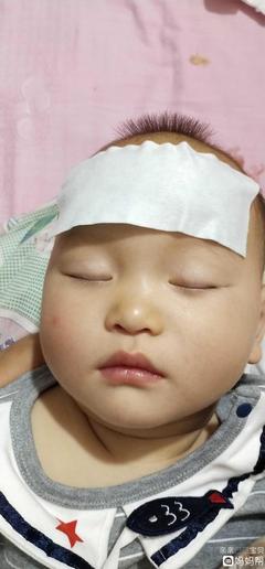 小孩子發(fā)燒39度怎么退燒最快？全面指南與關(guān)鍵措施，全面指南，兒童高燒39度快速退燒方法與關(guān)鍵措施