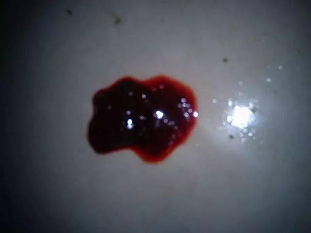 排便時(shí)出現(xiàn)撕裂感及出血，原因與應(yīng)對(duì)措施，排便疼痛撕裂感及出血，原因分析及應(yīng)對(duì)方法