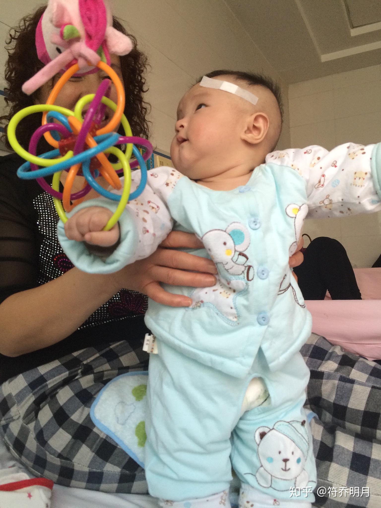 二個(gè)月嬰兒腦癱最明顯的特征，二個(gè)月嬰兒腦癱最明顯的特征表現(xiàn)